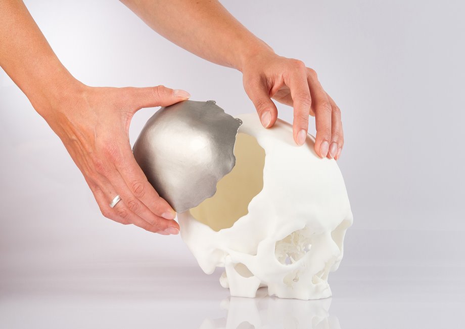 How to Test 3D Printed Medical - ASME