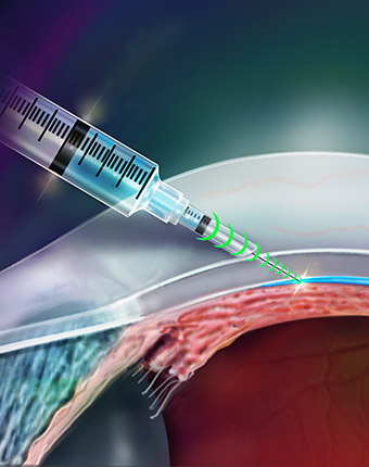 https://www.asme.org/getmedia/ABAB9945-1874-41E0-8370-0A13CBB814A4/How-to-Make-a-More-Precise-Hypodermic-Needle_01.aspx?data-width-removed=340