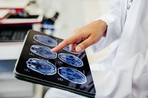 A person in a white lab coat points to a tablet displaying multiple cross-sectional brain scans.